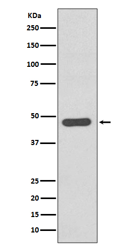 1 - Anti-Tissue Factor Rabbit Monoclonal Antibody ABO14161