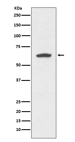 1 - Anti-Cytokeratin 9 KRT9 Rabbit Monoclonal Antibody ABO14162