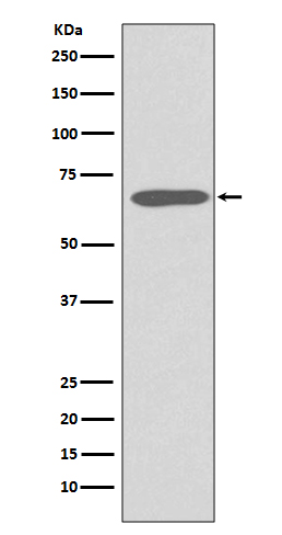 1 - Anti-Cytokeratin 1 Rabbit Monoclonal Antibody ABO14163