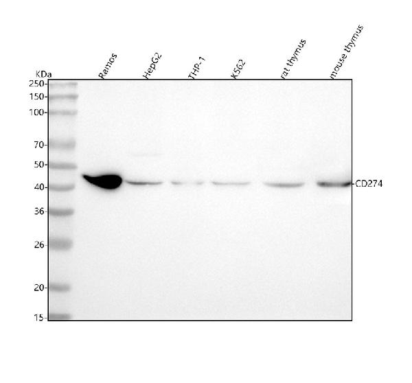 1 - Anti-PD-L1 (CD274) Rabbit Monoclonal Antibody ABO14165