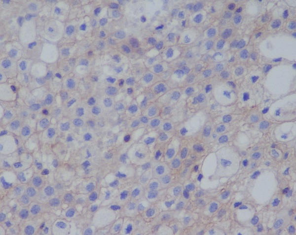 2 - Anti-PD-L1 (CD274) Rabbit Monoclonal Antibody ABO14165