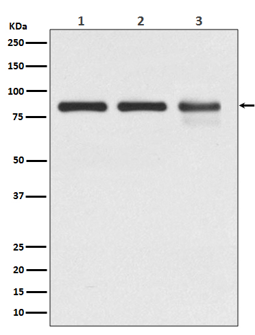 1 - Anti-Catenin gamma JUP Rabbit Monoclonal Antibody ABO14166