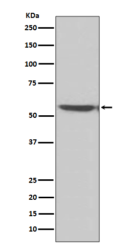 1 - Anti-Calcineurin A Rabbit Monoclonal Antibody ABO14168