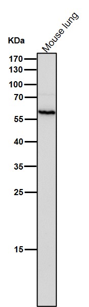 1 - Anti-Calcineurin A Rabbit Monoclonal Antibody ABO14168