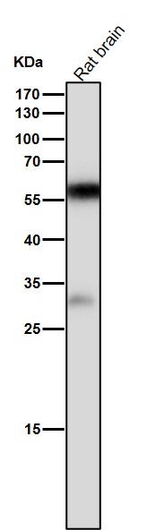 1 - Anti-Calcineurin A Rabbit Monoclonal Antibody ABO14168