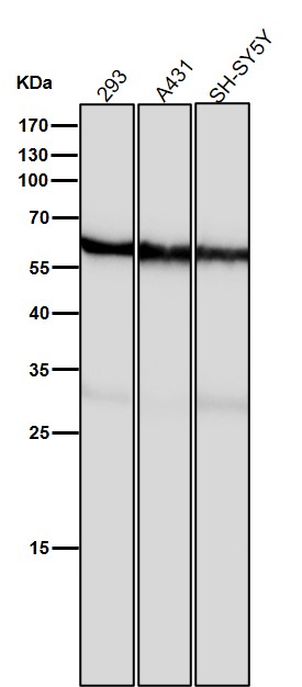 1 - Anti-Calcineurin A Rabbit Monoclonal Antibody ABO14168