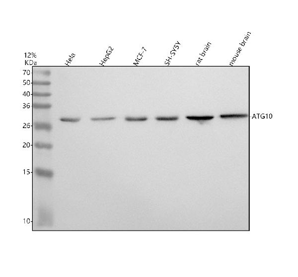 1 - Anti-Apg10 (Atg10) Rabbit Monoclonal Antibody ABO14169