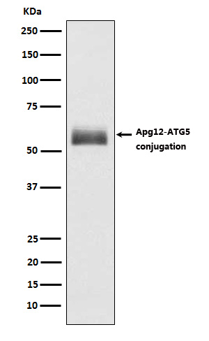1 - Anti-Apg12 (Atg12) Rabbit Monoclonal Antibody ABO14170