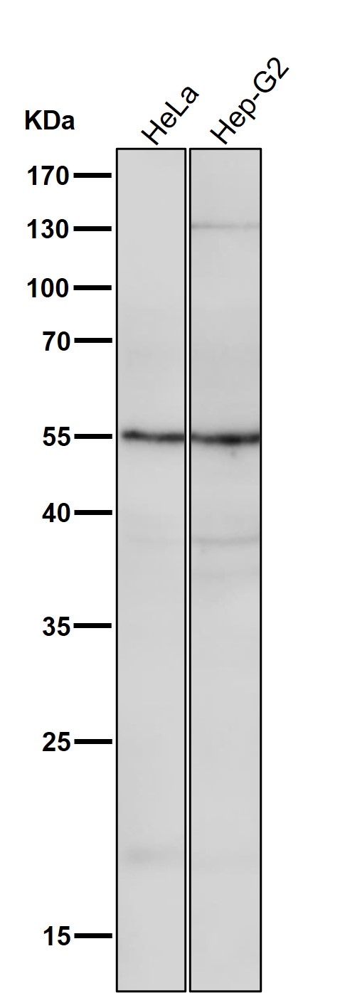 1 - Anti-Apg12 (Atg12) Rabbit Monoclonal Antibody ABO14170