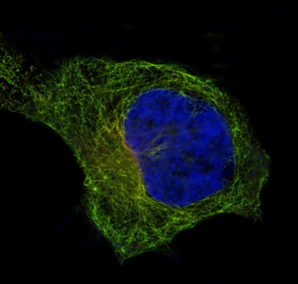 3 - Anti-beta I Tubulin TUBB1 Rabbit Monoclonal Antibody ABO14171