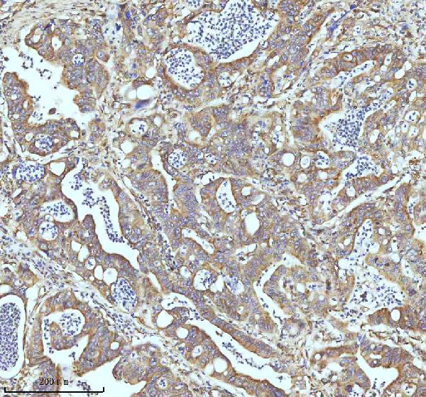 2 - Anti-beta I Tubulin TUBB1 Rabbit Monoclonal Antibody ABO14171