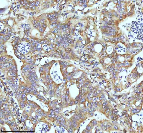 2 - Anti-beta I Tubulin TUBB1 Rabbit Monoclonal Antibody ABO14171