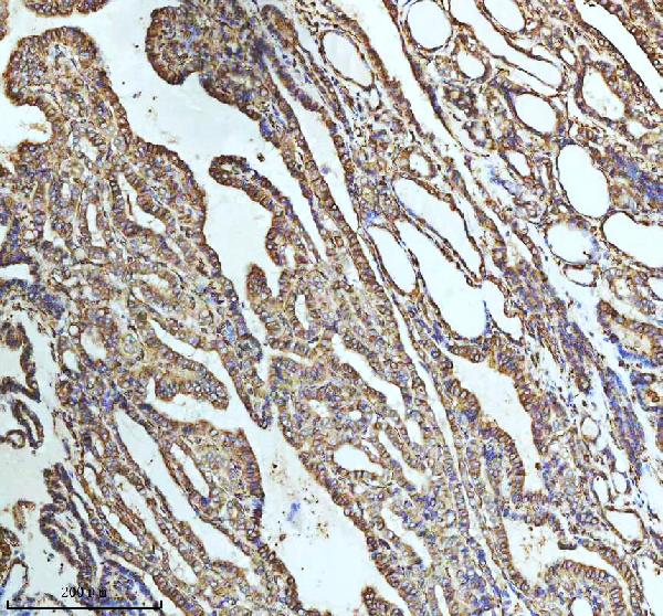 2 - Anti-beta I Tubulin TUBB1 Rabbit Monoclonal Antibody ABO14171