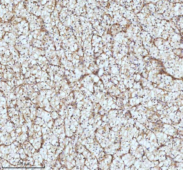 2 - Anti-beta I Tubulin TUBB1 Rabbit Monoclonal Antibody ABO14171