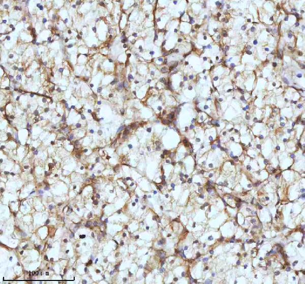 2 - Anti-beta I Tubulin TUBB1 Rabbit Monoclonal Antibody ABO14171