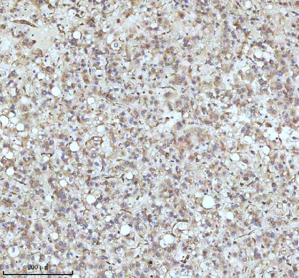 2 - Anti-beta I Tubulin TUBB1 Rabbit Monoclonal Antibody ABO14171