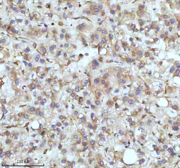 2 - Anti-beta I Tubulin TUBB1 Rabbit Monoclonal Antibody ABO14171