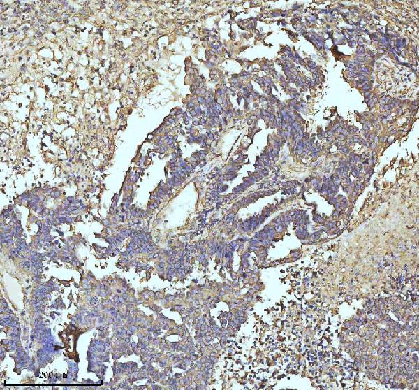 2 - Anti-beta I Tubulin TUBB1 Rabbit Monoclonal Antibody ABO14171