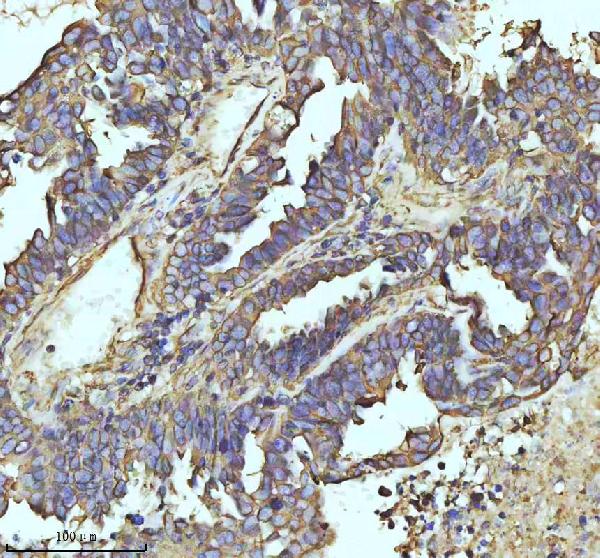 2 - Anti-beta I Tubulin TUBB1 Rabbit Monoclonal Antibody ABO14171