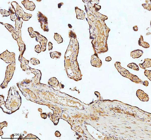 2 - Anti-beta I Tubulin TUBB1 Rabbit Monoclonal Antibody ABO14171