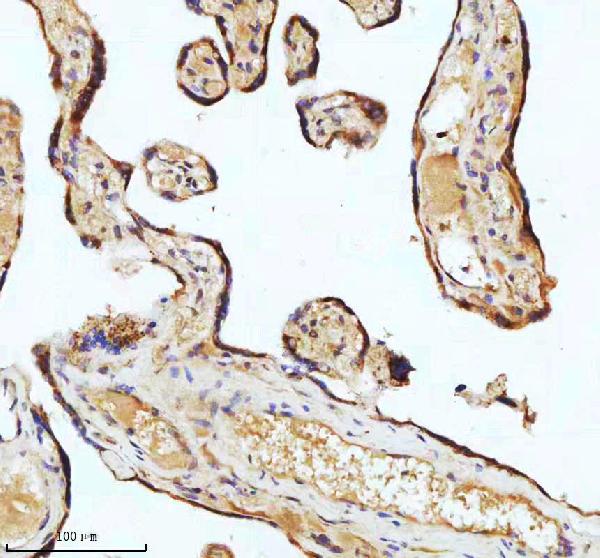 2 - Anti-beta I Tubulin TUBB1 Rabbit Monoclonal Antibody ABO14171