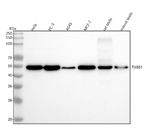 1 - Anti-beta I Tubulin TUBB1 Rabbit Monoclonal Antibody ABO14171