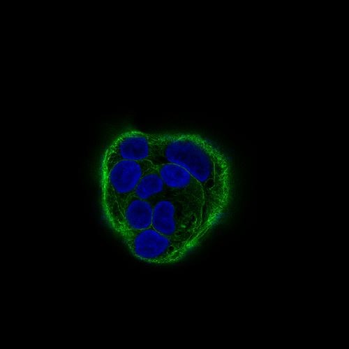 3 - Anti-Cytokeratin 18 KRT18 Rabbit Monoclonal Antibody ABO14173