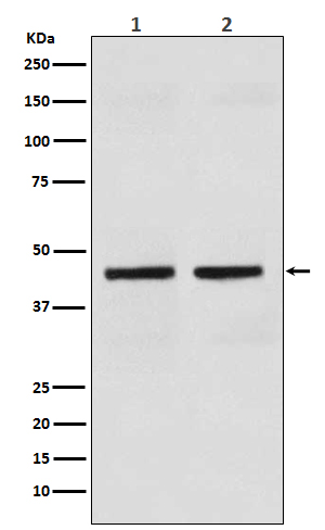 1 - Anti-Cytokeratin 18 KRT18 Rabbit Monoclonal Antibody ABO14173