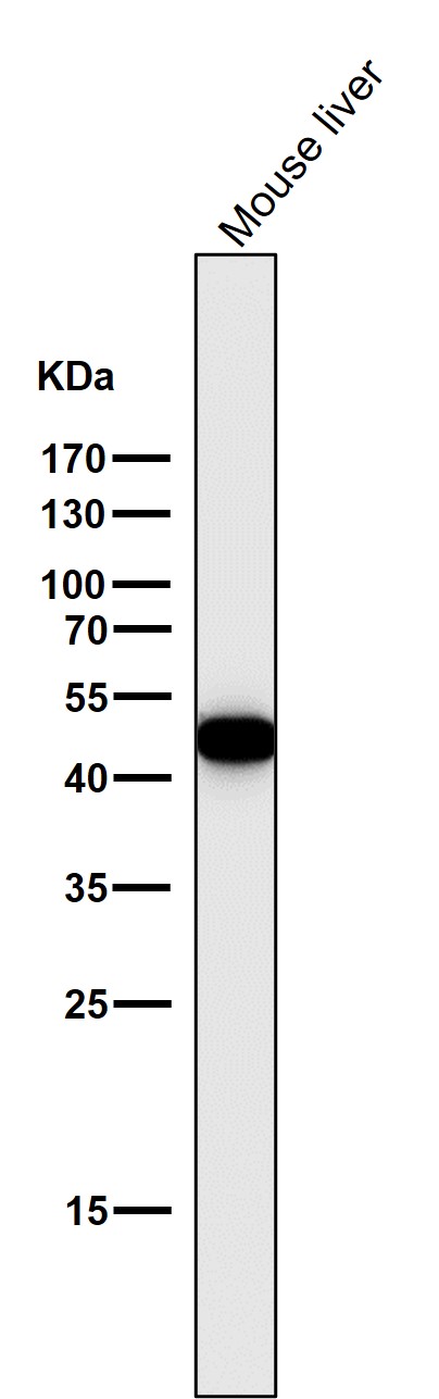 1 - Anti-Cytokeratin 18 KRT18 Rabbit Monoclonal Antibody ABO14173