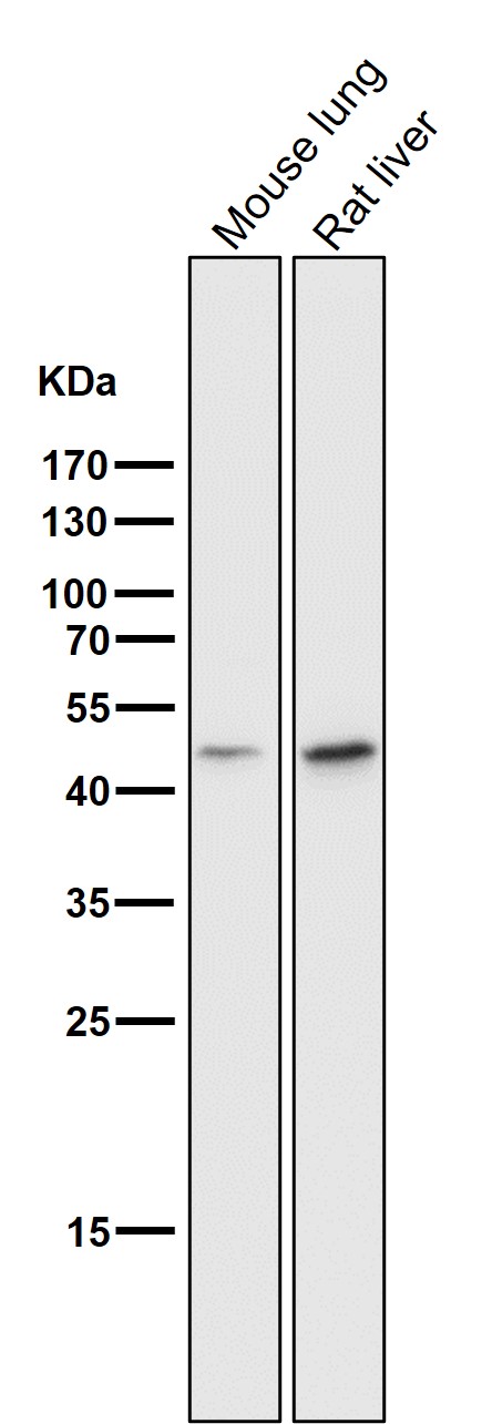 1 - Anti-Cytokeratin 18 KRT18 Rabbit Monoclonal Antibody ABO14173