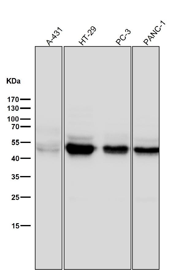 1 - Anti-Cytokeratin 18 KRT18 Rabbit Monoclonal Antibody ABO14173