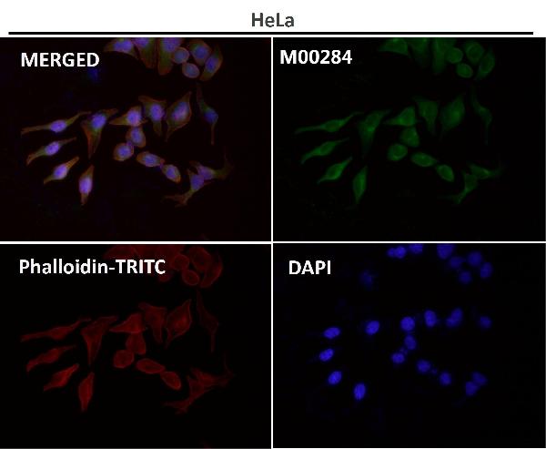 1 - Anti-NF-Kappa B p65 RELA Rabbit Monoclonal Antibody ABO14174