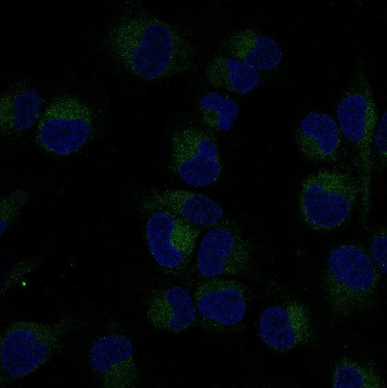 3 - Anti-NF-Kappa B p65 RELA Rabbit Monoclonal Antibody ABO14174