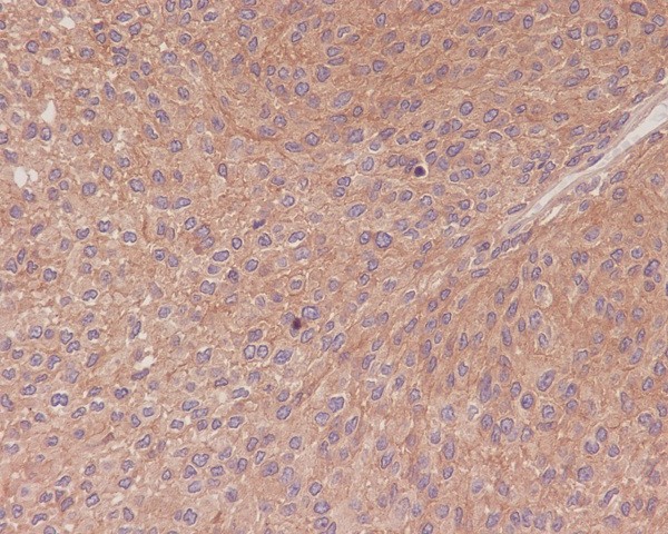 2 - Anti-NF-Kappa B p65 RELA Rabbit Monoclonal Antibody ABO14174
