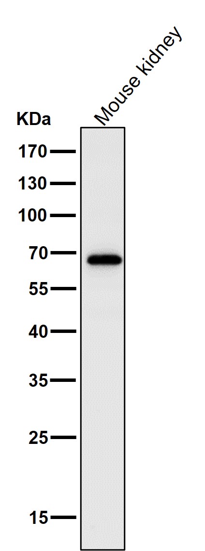 1 - Anti-NF-Kappa B p65 RELA Rabbit Monoclonal Antibody ABO14174