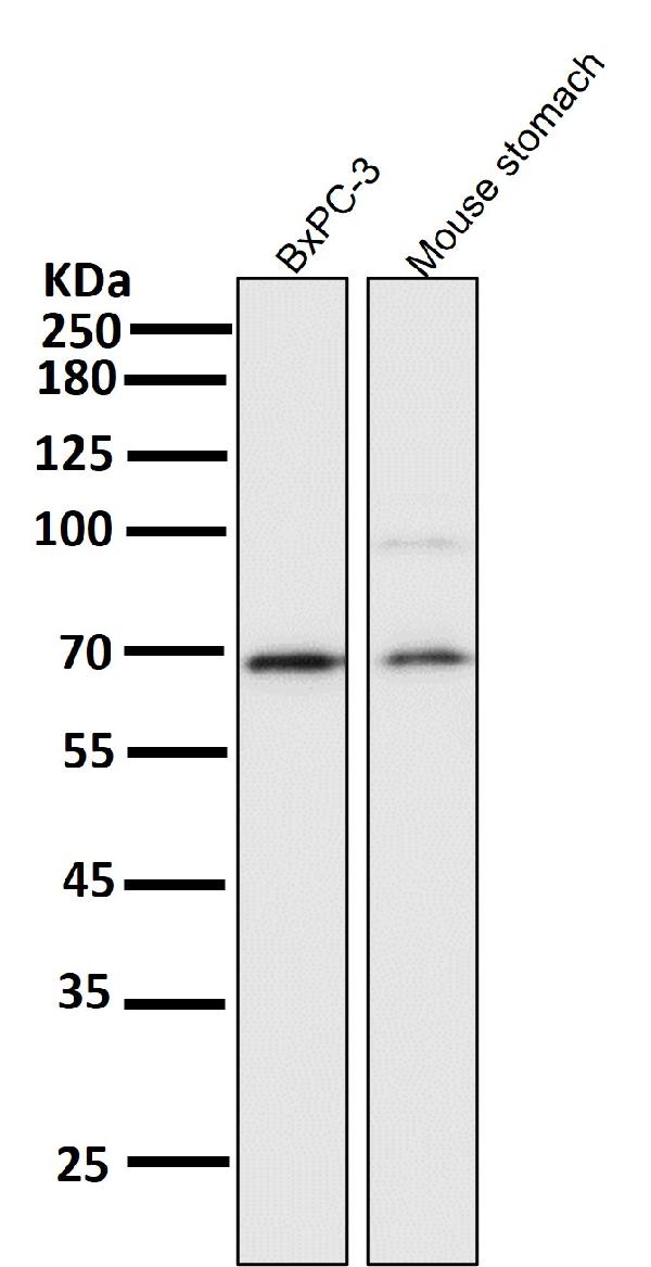 1 - Anti-NF-Kappa B p65 RELA Rabbit Monoclonal Antibody ABO14174