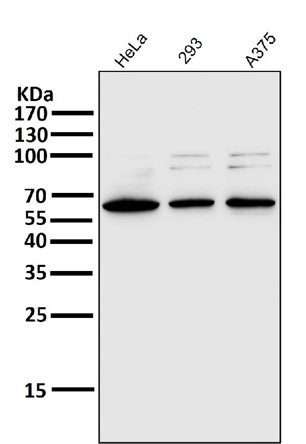 1 - Anti-NF-Kappa B p65 RELA Rabbit Monoclonal Antibody ABO14174
