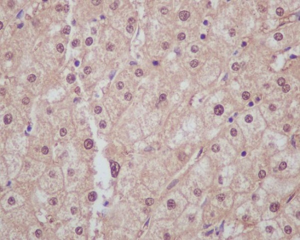2 - Anti-Liver Arginase ARG1 Rabbit Monoclonal Antibody ABO14175