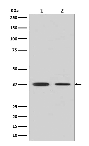 1 - Anti-Liver Arginase ARG1 Rabbit Monoclonal Antibody ABO14175