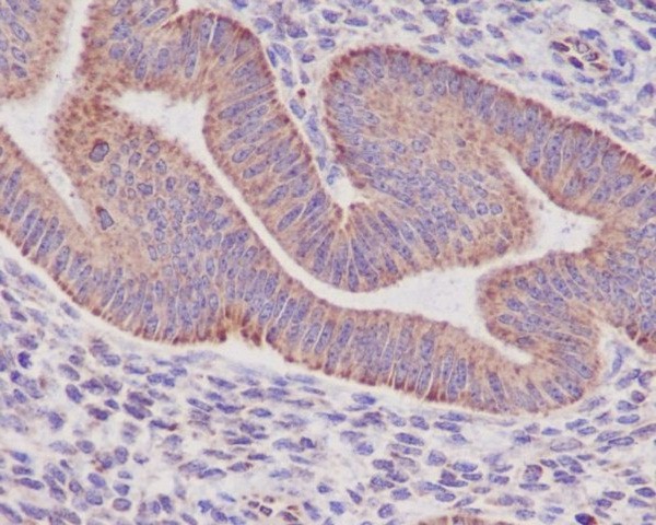 2 - Anti-Sonic Hedgehog SHH Rabbit Monoclonal Antibody ABO14176