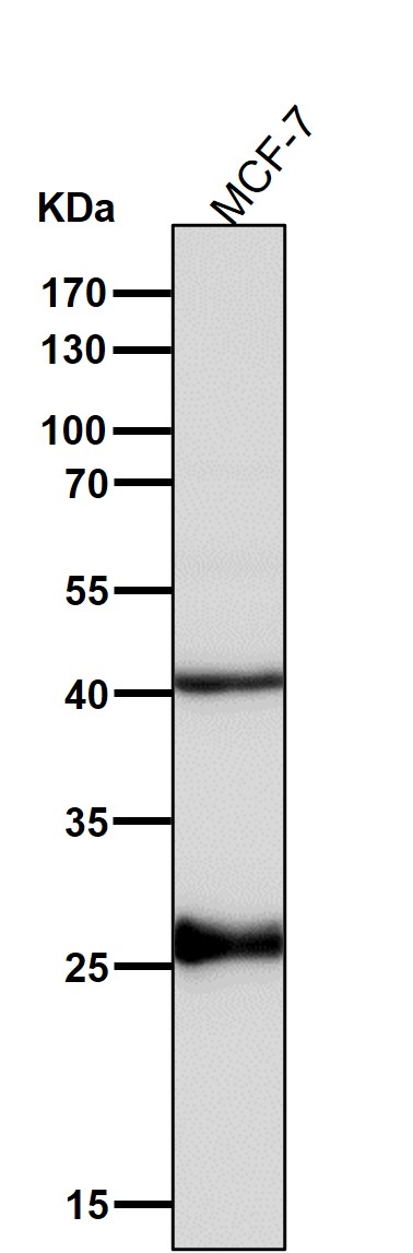 1 - Anti-Sonic Hedgehog SHH Rabbit Monoclonal Antibody ABO14176
