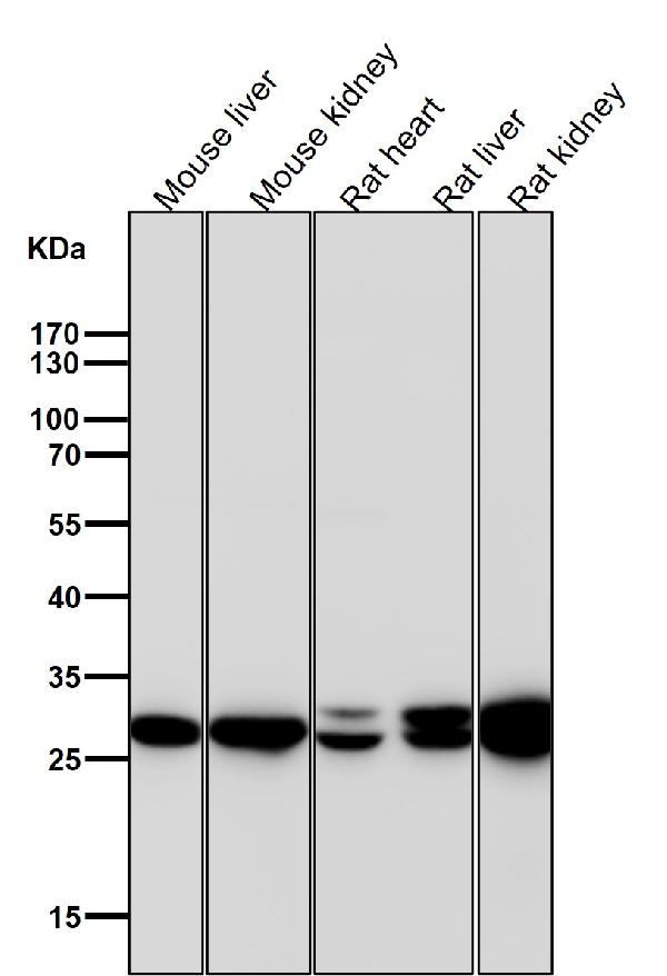 1 - Anti-Sonic Hedgehog SHH Rabbit Monoclonal Antibody ABO14176
