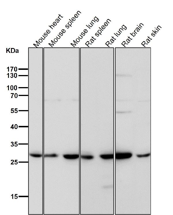 1 - Anti-Sonic Hedgehog SHH Rabbit Monoclonal Antibody ABO14176