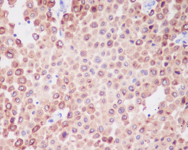 2 - Anti-PMEL17 / GP100 Rabbit Monoclonal Antibody ABO14177