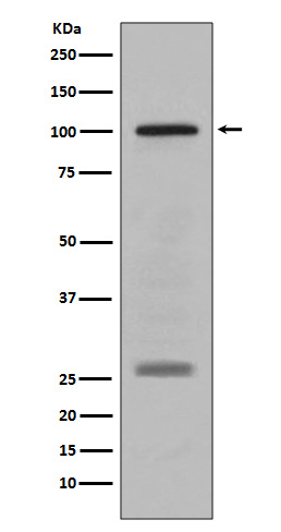 1 - Anti-PMEL17 / GP100 Rabbit Monoclonal Antibody ABO14177