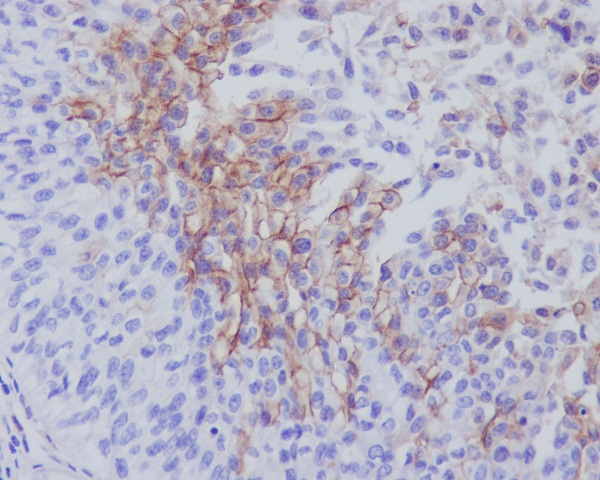 2 - Anti-Thrombomodulin THBD Rabbit Monoclonal Antibody ABO14178