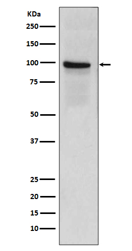 1 - Anti-Thrombomodulin THBD Rabbit Monoclonal Antibody ABO14178