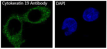 3 - Anti-Cytokeratin 19 KRT19 Rabbit Monoclonal Antibody ABO14179