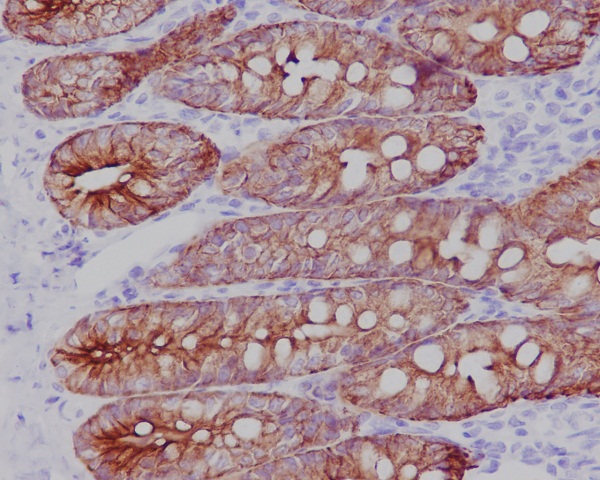 2 - Anti-Cytokeratin 19 KRT19 Rabbit Monoclonal Antibody ABO14179