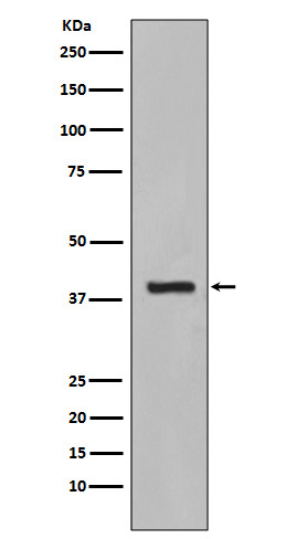 1 - Anti-Cytokeratin 19 KRT19 Rabbit Monoclonal Antibody ABO14179